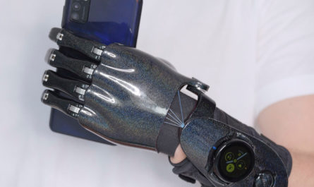 Бионический протез с Galaxy Watch
