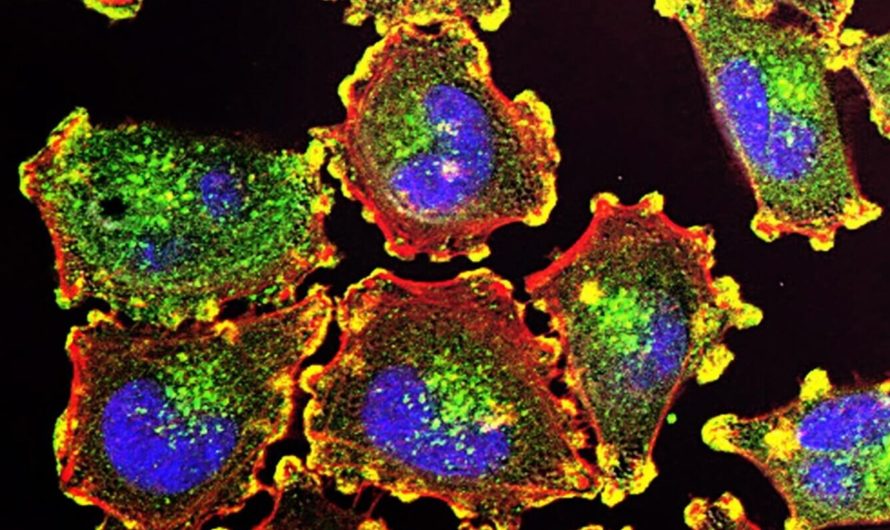 ИИ научился предсказывать, какие комбинации лекарств убивают раковые клетки