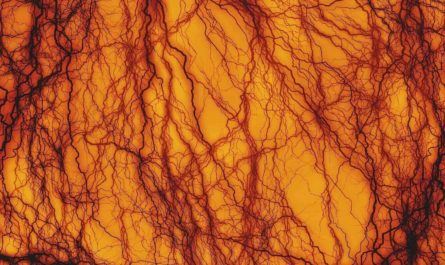 Сужения кровеносных сосудов ищут нейросети