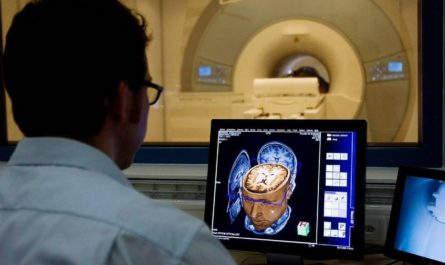Опухоли на 3D-снимках мозга находит ИИ