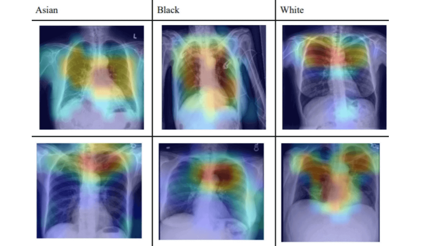 AI Recognises Patient's Racial Identity In Medical Images