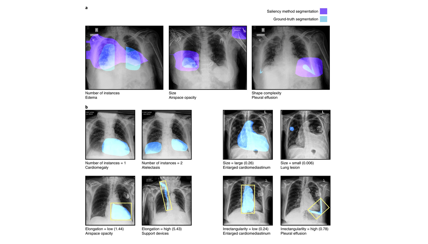 Benchmarking saliency methods for chest X-ray