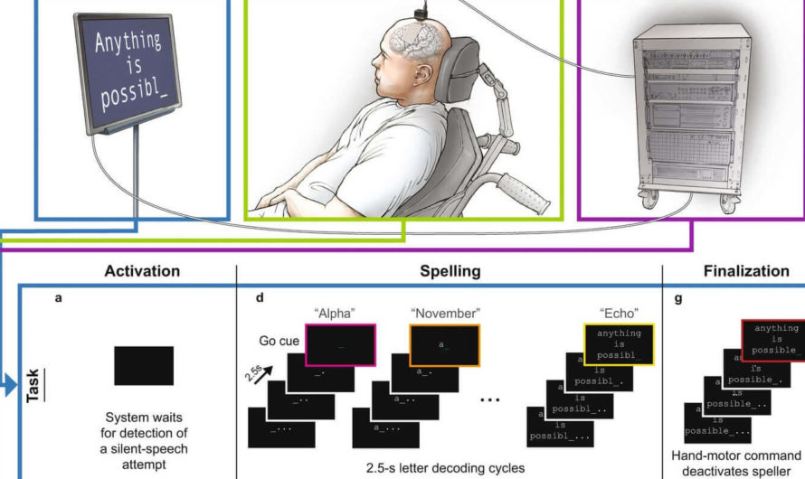 Создана нейросистема для распознавания речи парализованных людей