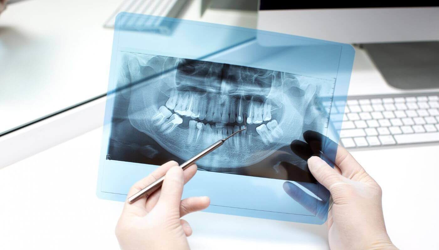 Gender classification dental X-ray
