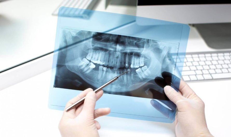 Нейросеть научилась определять пол людей по рентгеновским снимкам зубов