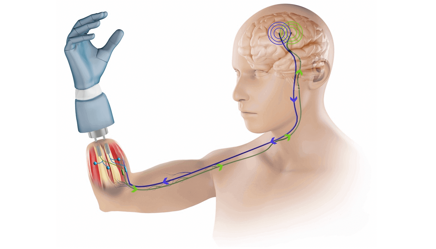 Highly integrated bionic hand